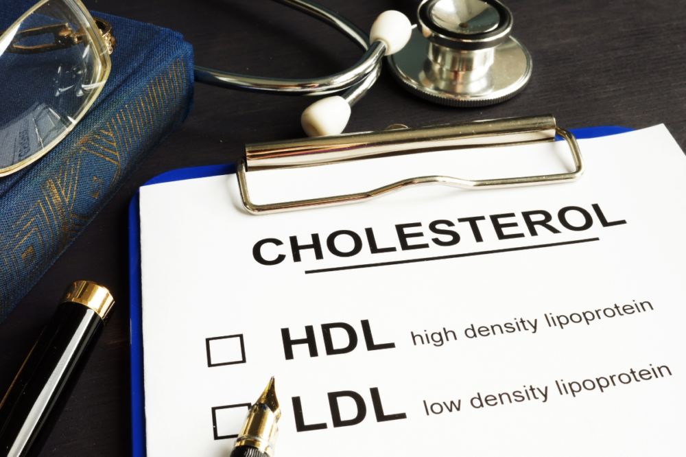 medical history for cholesterol, HDL, LDL next to stethoscope