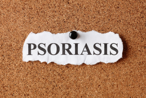 χαρτάκι που γράφει psoriasis κολλημένο με πινέζα σε πίνακα