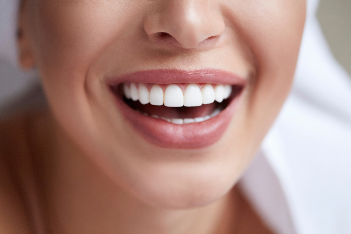 Γυναίκα που χαμογελάει με πολύ λευκά δόντια.