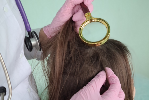 γιατρός εξετάζει με μεγεθυντικό φακό το κεφάλι κοπέλας